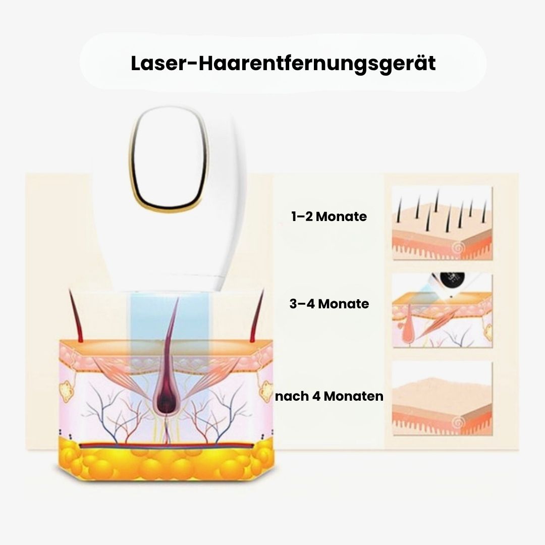 Skinvasion - permanentes IPL-Haarentfernungsgerät