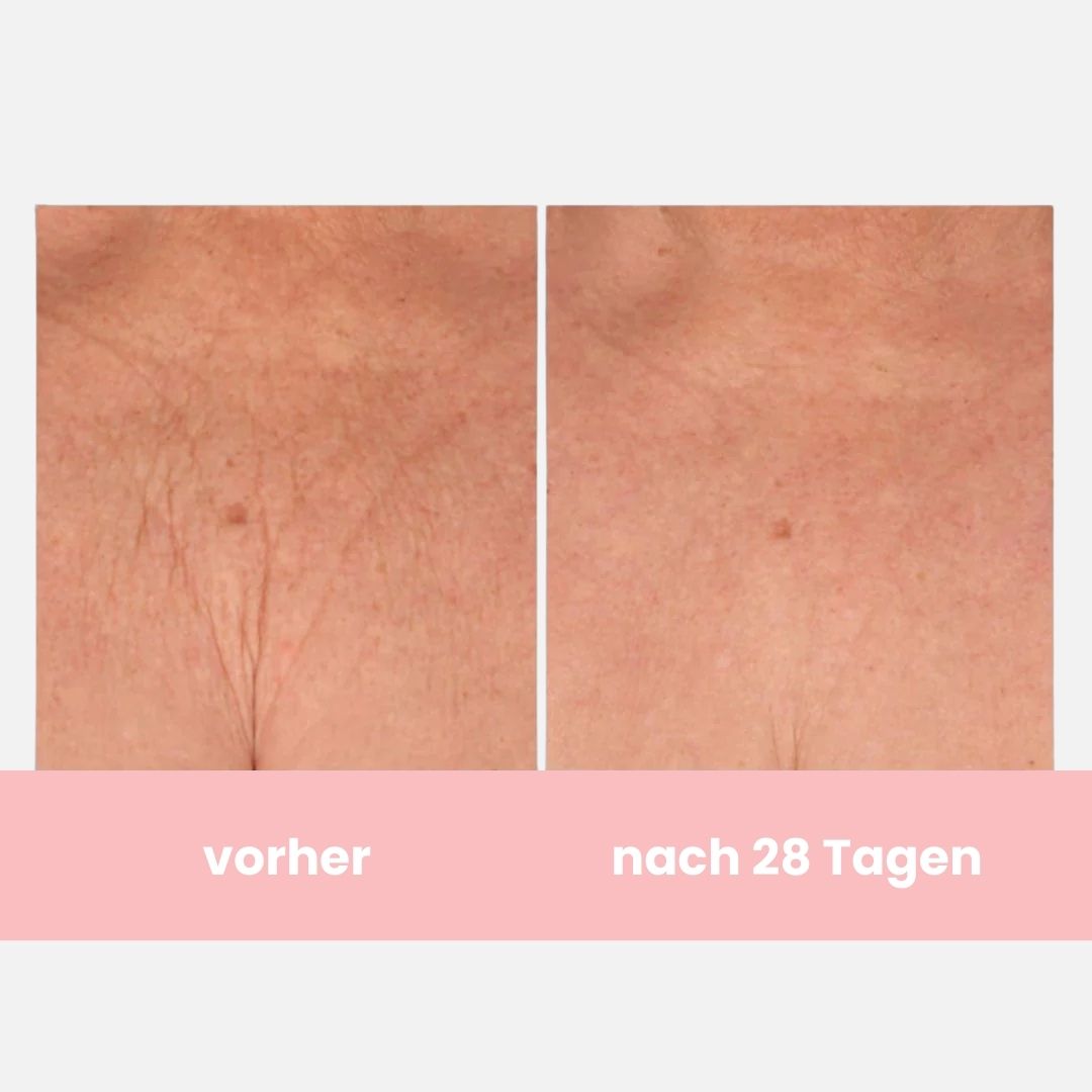 Skinvasion – Champagner Beauty Lifting Creme