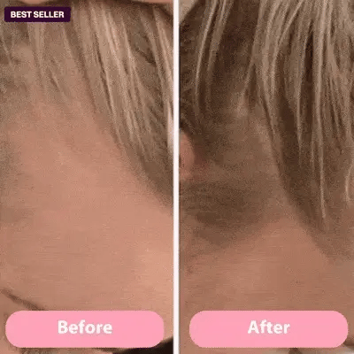 Skinvasion - Rotlicht HairFlow-Stimulationsbürste