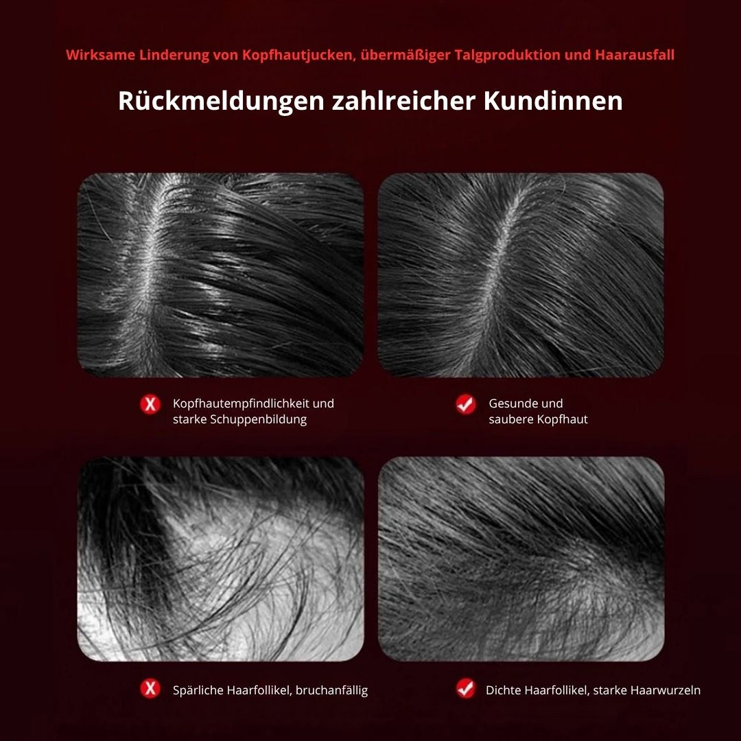 Skinvasion - Rotlicht HairFlow-Stimulationsbürste
