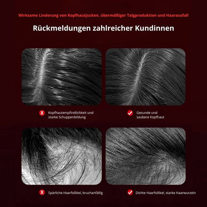 Skinvasion - Rotlicht HairFlow-Stimulationsbürste